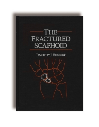 The Fractured Scaphoid