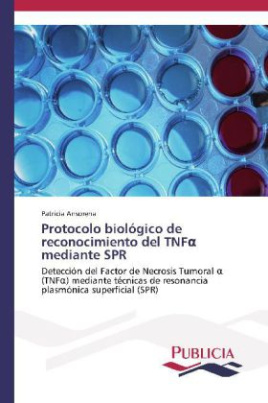 Protocolo biológico de reconocimiento del TNF mediante SPR