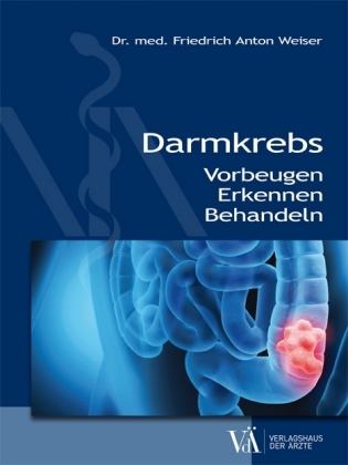 Darmkrebs