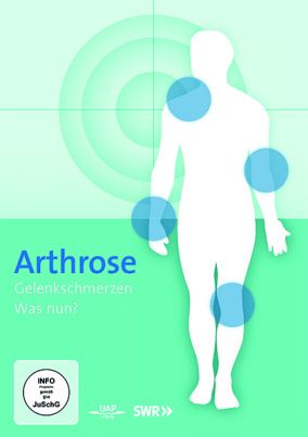 Arthrose - Was nun?