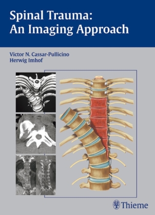 Spinal Trauma