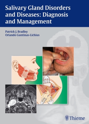 Salivary Gland Disorders and Diseases