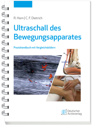 Ultraschall des Bewegungsapparates