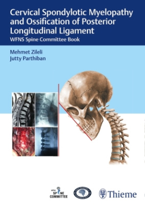 Cervical Spondylotic Myelopathy and Ossification of Posterior Longitudinal Ligament