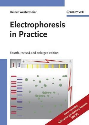 Electrophoresis in Practice